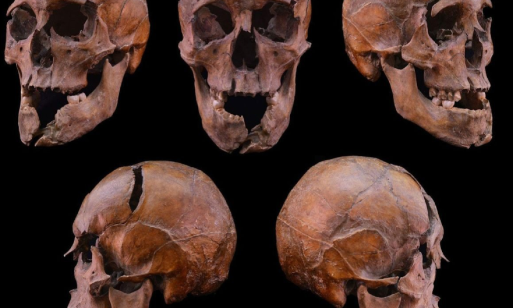 Archaeologists Solve 700-Year-Old Mystery of Murdered Hungarian Duke