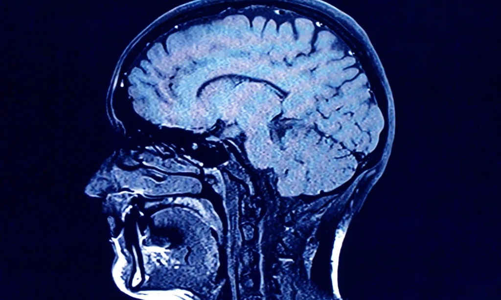 Human brains have 5 distinct 'epochs' in a lifetime, study finds