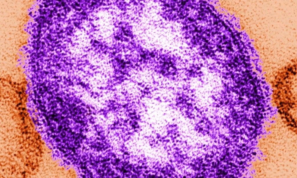 South Carolina saw a 68% surge in measles cases in a week, impacted by holiday activities and delayed vaccinations.