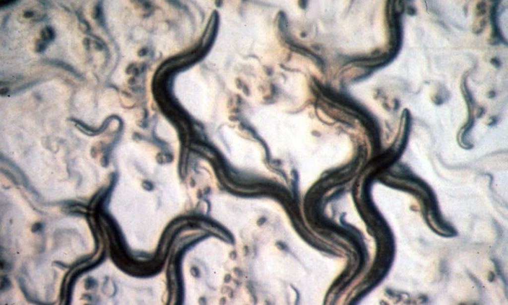 Does it even need to be said? No, you don’t need to do a ‘parasite cleanse’